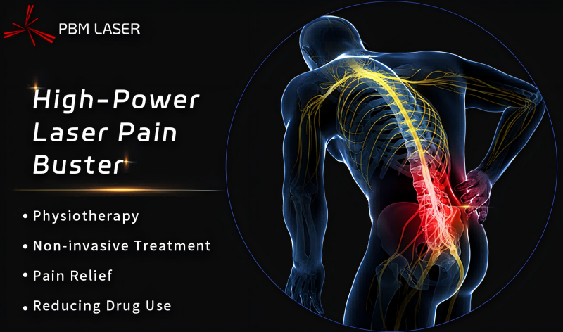 PBM Medical Laser 丨 Unlocking the Rehabilitation Code, High-Power Laser Recommendation A in China's Chronic Low Back Pain Guidelines (ສະບັບປີ 2024)